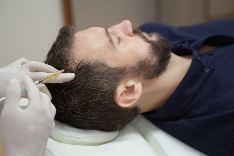 Hair Mesotherapy Treatment