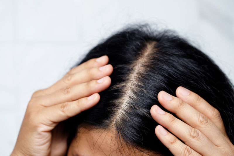Oily & Itchy Scalp Treatment
